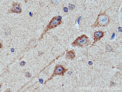 [21186-1-AP-150UL] KIF5A Polyclonal antibody