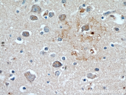 [21191-1-AP-20UL] KLHL4 Polyclonal antibody
