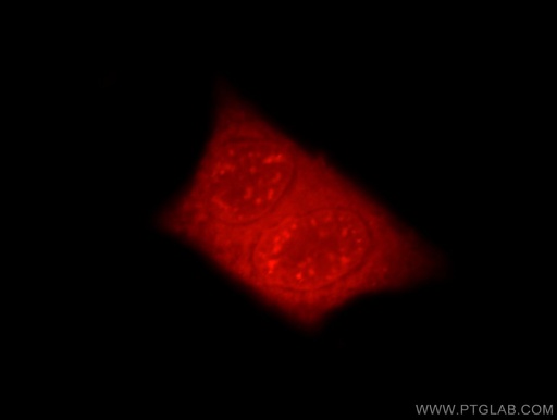 [21196-1-AP-20UL] EYA3 Polyclonal antibody