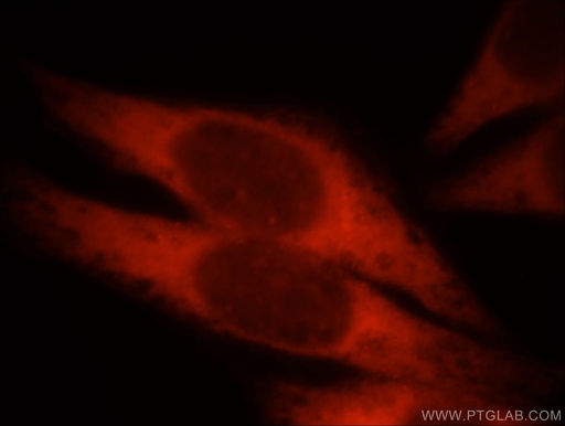[21199-1-AP-150UL] KLHL35 Polyclonal antibody