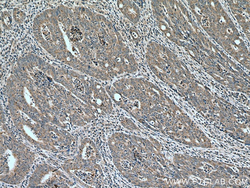 [21203-1-AP-20UL] FAM72 Polyclonal antibody