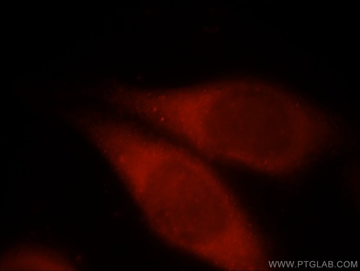 [21204-1-AP-20UL] PCDHGB3 Polyclonal antibody