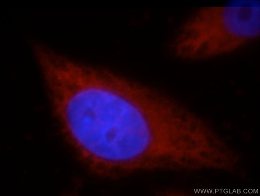 [21206-1-AP-150UL] HSPA4 Polyclonal antibody