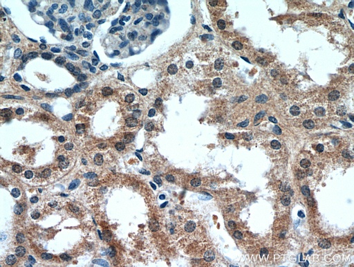 [21209-1-AP-20UL] CCDC25 Polyclonal antibody