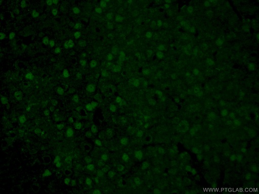 [21215-1-AP-20UL] ATOH1 Polyclonal antibody