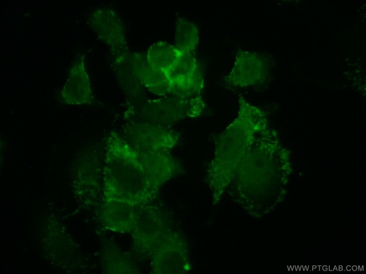 [21220-1-AP-20UL] AAMP Polyclonal antibody