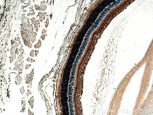 [21222-1-AP-20UL] CPLX4 Polyclonal antibody
