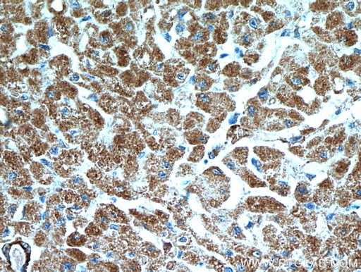 [21223-1-AP-20UL] SCO2 Polyclonal antibody