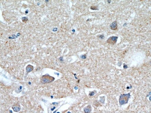 [21228-1-AP-20UL] HAPLN4 Polyclonal antibody