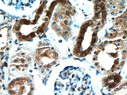 [21233-1-AP-20UL] KCNQ1DN Polyclonal antibody