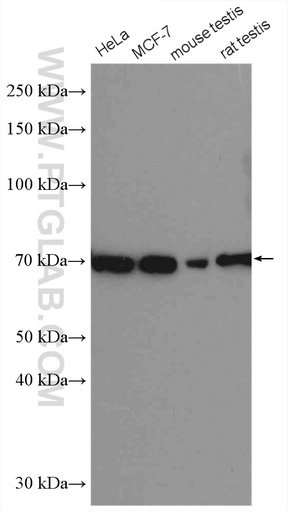 [21244-1-AP-150UL] ER Polyclonal antibody