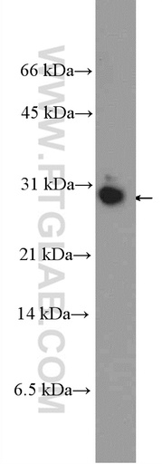 [21246-1-AP-20UL] HMGB3L1 Polyclonal antibody