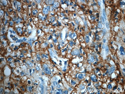 [21247-1-AP-20UL] ITIH3 Polyclonal antibody