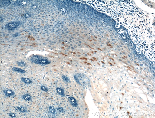 [21249-1-AP-150UL] AGRP Polyclonal antibody