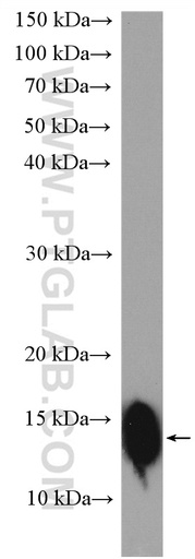 [21252-1-AP-20UL] FABP2 Polyclonal antibody