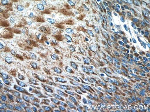 [21255-1-AP-150UL] IL-36 Gamma Polyclonal antibody