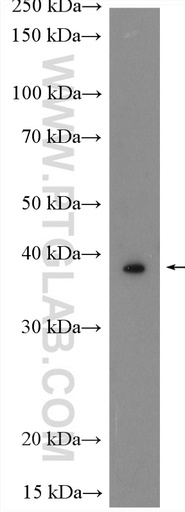 [21259-1-AP-150UL] WISP3 Polyclonal antibody