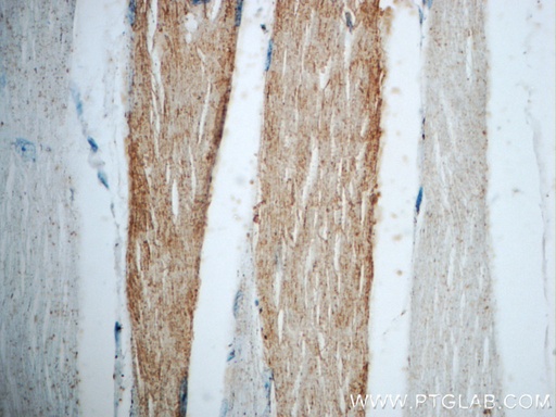 [21263-1-AP-150UL] NEURL2 Polyclonal antibody