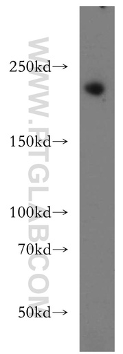 [21269-1-AP-150UL] RB1CC1 Polyclonal antibody