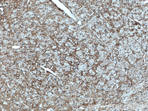 [21271-1-AP-20UL] SV2C Polyclonal antibody
