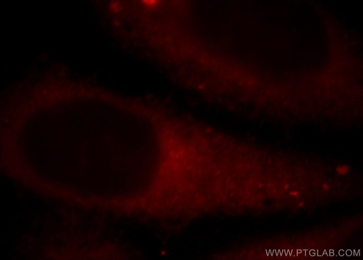 [21277-1-AP-20UL] SR-BI Polyclonal antibody