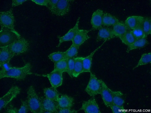 [21278-1-AP-20UL] AMIGO3 Polyclonal antibody