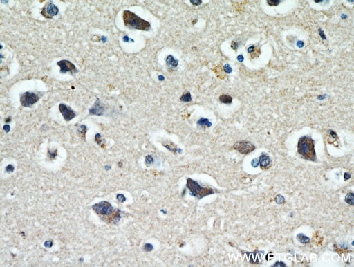 [21280-1-AP-20UL] WBSCR17 Polyclonal antibody