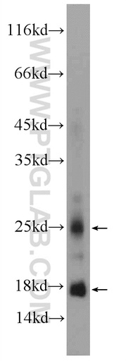 [21281-1-AP-150UL] CRYGN Polyclonal antibody