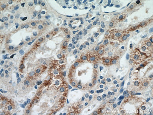 [21286-1-AP-150UL] MOGAT2 Polyclonal antibody