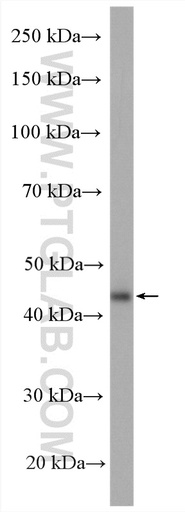 [21291-1-AP-150UL] B3GNT6 Polyclonal antibody
