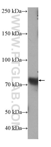 [21295-1-AP-150UL] SLC34A2 Polyclonal antibody