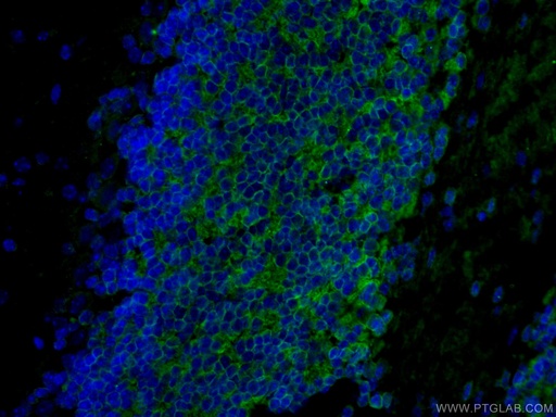 [21298-1-AP-150UL] Kv4.2 Polyclonal antibody