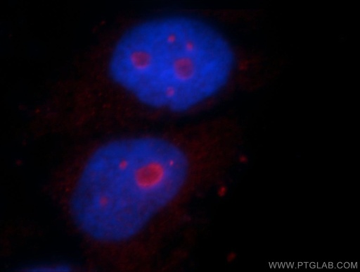 [21299-1-AP-20UL] PLK5 Polyclonal antibody