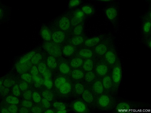 [21305-1-AP-20UL] SIX4 Polyclonal antibody
