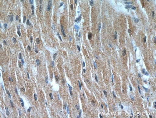 [21310-1-AP-20UL] NHLRC1 Polyclonal antibody