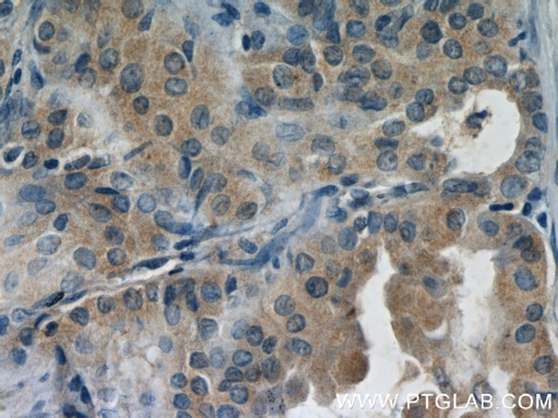 [21312-1-AP-20UL] DEPDC6 Polyclonal antibody