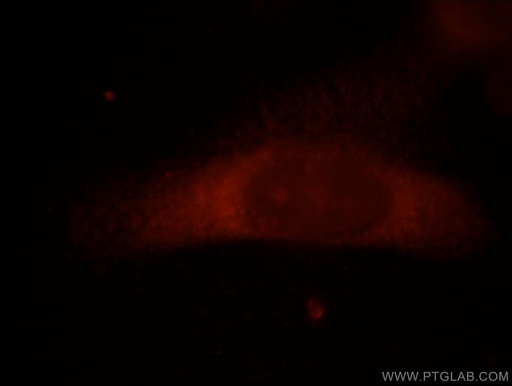 [21313-1-AP-150UL] FAM124B Polyclonal antibody