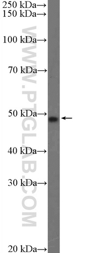 [21314-1-AP-150UL] TMEM117 Polyclonal antibody
