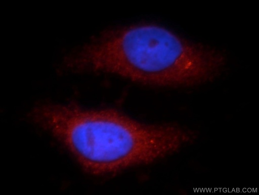 [21323-1-AP-150UL] TTC39A Polyclonal antibody