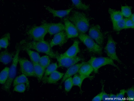 [21325-1-AP-150UL] STARD13 Polyclonal antibody