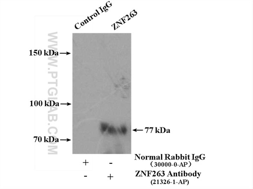 [21326-1-AP-150UL] ZNF263 Polyclonal antibody