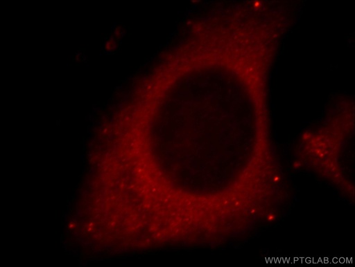 [21327-1-AP-150UL] Cathepsin D Polyclonal antibody