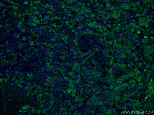 [21337-1-AP-20UL] C3/C3b/C3c Polyclonal antibody