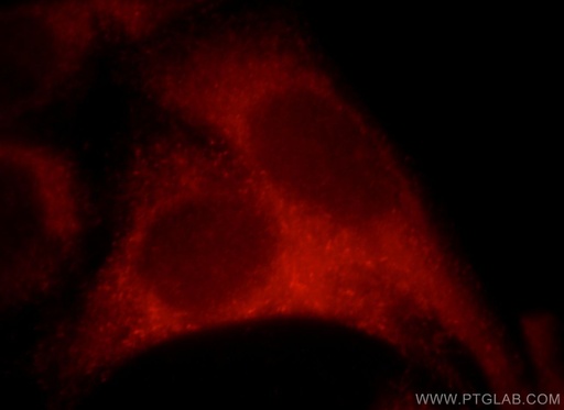 [21346-1-AP-20UL] Sestrin 2 Polyclonal antibody