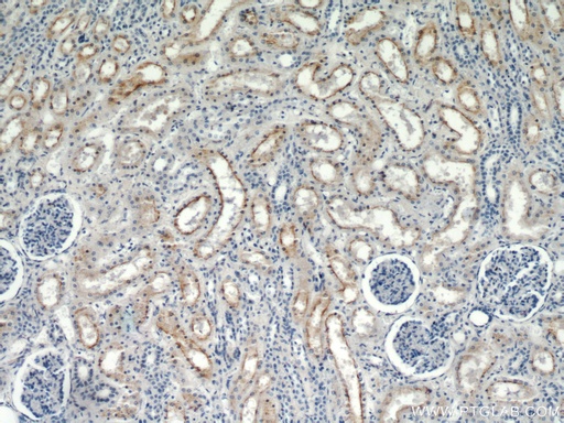 [21349-1-AP-20UL] TRPC4 Polyclonal antibody