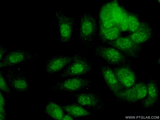 [21350-1-AP-150UL] SNAI3 Polyclonal antibody