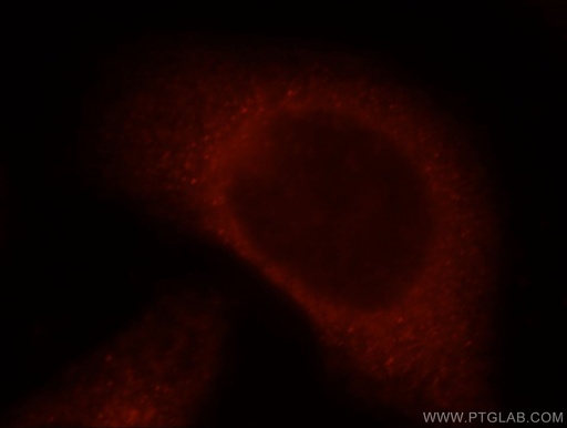 [21359-1-AP-150UL] ITGB1BP2 Polyclonal antibody