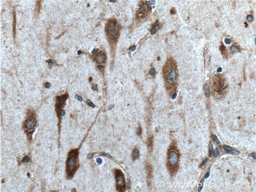[21360-1-AP-20UL] CCDC55 Polyclonal antibody