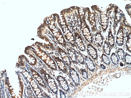 [21370-1-AP-20UL] PLCB3 Polyclonal antibody