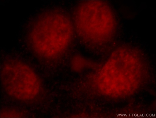 [21371-1-AP-20UL] PKIG Polyclonal antibody